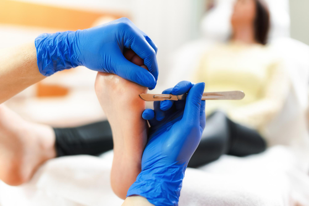 https://nailsurgeryclinic.ie/wp-content/uploads/2023/08/professional-pedicure-using-dieffenbach-scalpelpatient-visiting-podiatristmedical-pedicure-procedure-using-special-instrument-with-blade-knife-holderfoot-treatment-spa-salon.jpg